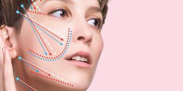 بهترین سن برای لیفت با نخ چه زمانی است؟