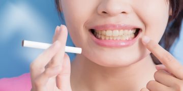 تأثیر سیگار بر لمینت دندان؛ چطور از زرد شدن جلوگیری کنیم؟