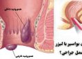 دکتر هموروئید در تهران