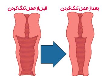 جراح زیبایی زنان در بلوار فردوس